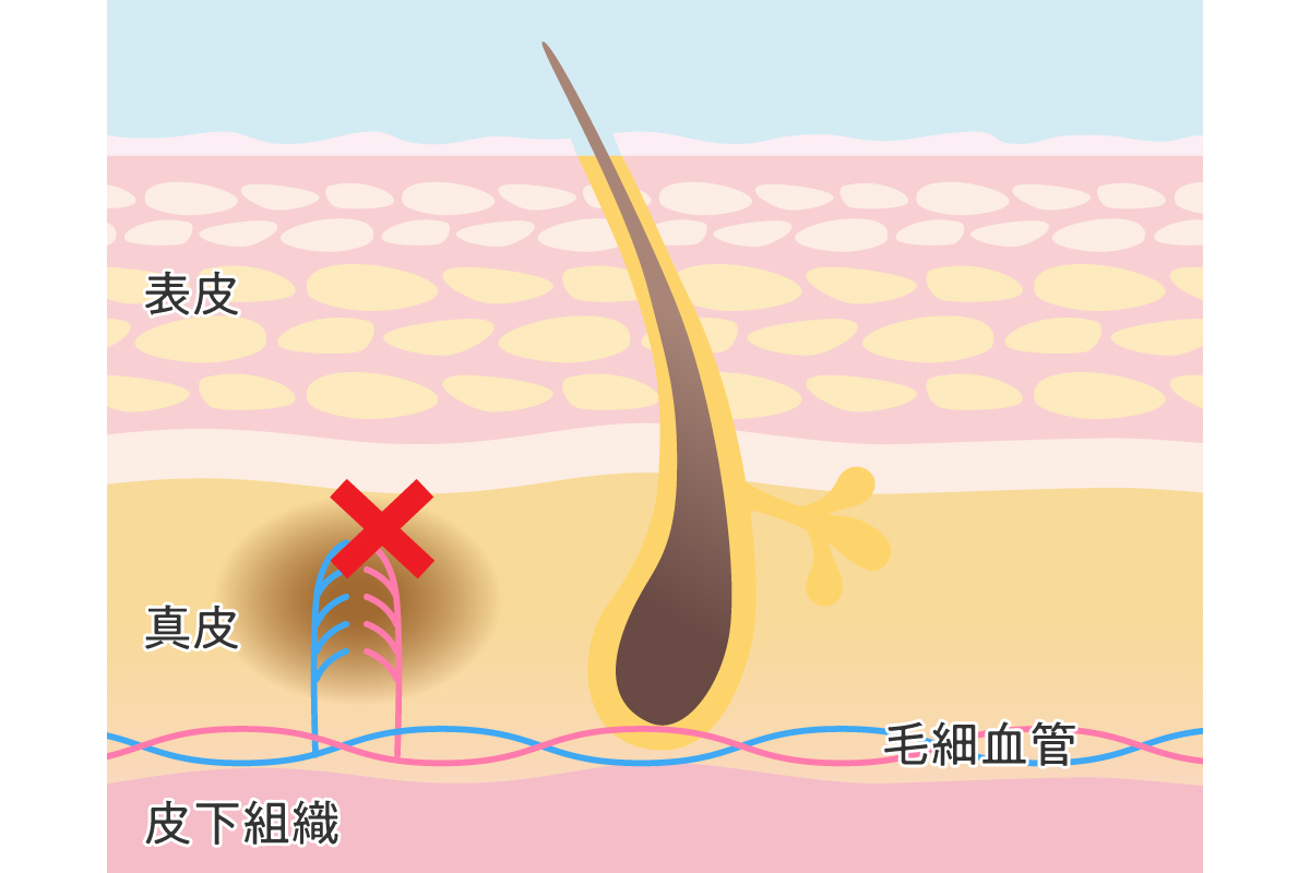 おっぱいがイッパイ！セクキャバの「花びら回転」とは？ | ぱふなびチャンネル