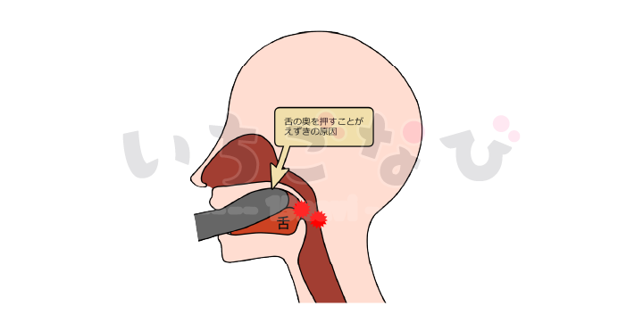 口内にキツマン!? イラマチオを疑似体験できる高刺激フェラホール『真実の口 ぺろりん 喉輪締めHARDタイプ』