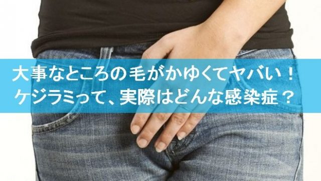 Amazon.co.jp: 風俗１回でも一生治らないこわい性病: 舐めるだけでもうつる (日本メディカル出版) eBook