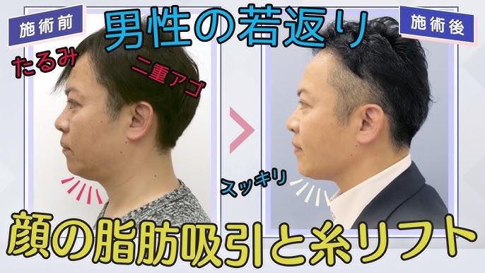 30代、40代男性の肌悩みについて調査】 前年比163％と成長を続けるメンズスキンケア市場に30代、40代男性が大きく影響？ 