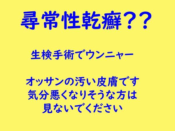 人生で初めてエイズ検査を受けました。 ｜ みやえら公式ブログ SEO集客で800個のアフィリエイトサイト運営