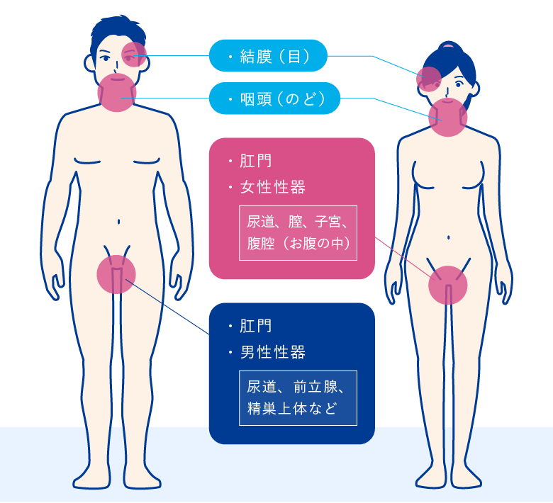 扁桃炎、のどの痛みの治療は足立区ひろい耳鼻咽喉科クリニックへ