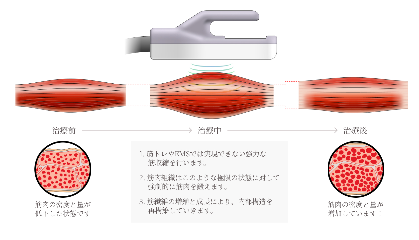 WAVEWAVE EMS HEAT EYE