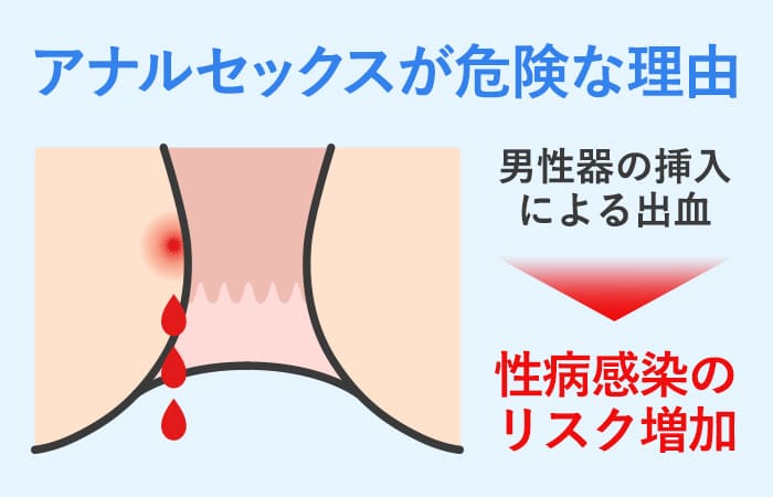 50cm浣腸洗浄水ノズル携帯用ラテックスプラグ洗浄BDSMゲイアナルセックスおもちゃを￥933 | DHgate