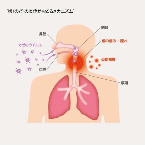 医師が解説】熱はないのに喉が痛い！これって風邪？病院に行った方がいいの？ – EPARKくすりの窓口コラム｜ヘルスケア情報