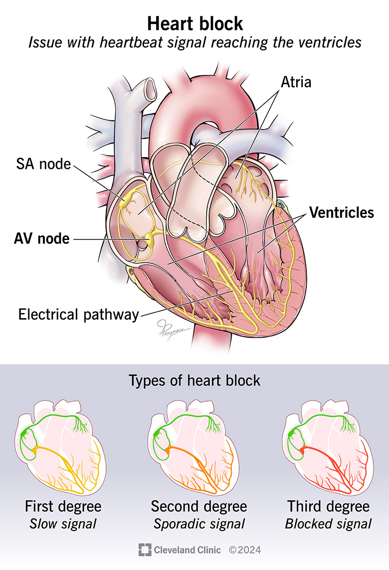 Hearts of Darkness