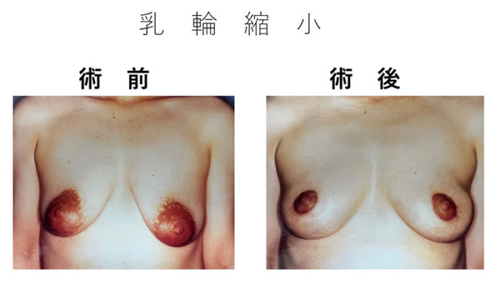 巨乳輪エロ画像デカ乳輪ならおっぱい本体も大きい方が - エロ