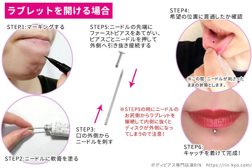 ピアスを開けて以来、後頭部から側頭部にかけて痛む｜頭痛のツボ｜ツボネット 鍼灸の症例が検索できるツボ辞典