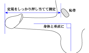 ちんちん・股間の異常や睾丸の鈍い痛み・不快感｜まるばね泌尿器科クリニック北区東十条