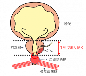 男の前立腺の場所 | 【きもイク】気持ちよくイクカラダ