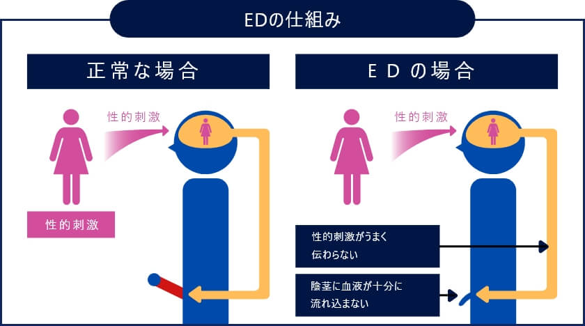 ED（勃起不全）を自力で治すには｜【浜松町第一クリニック】