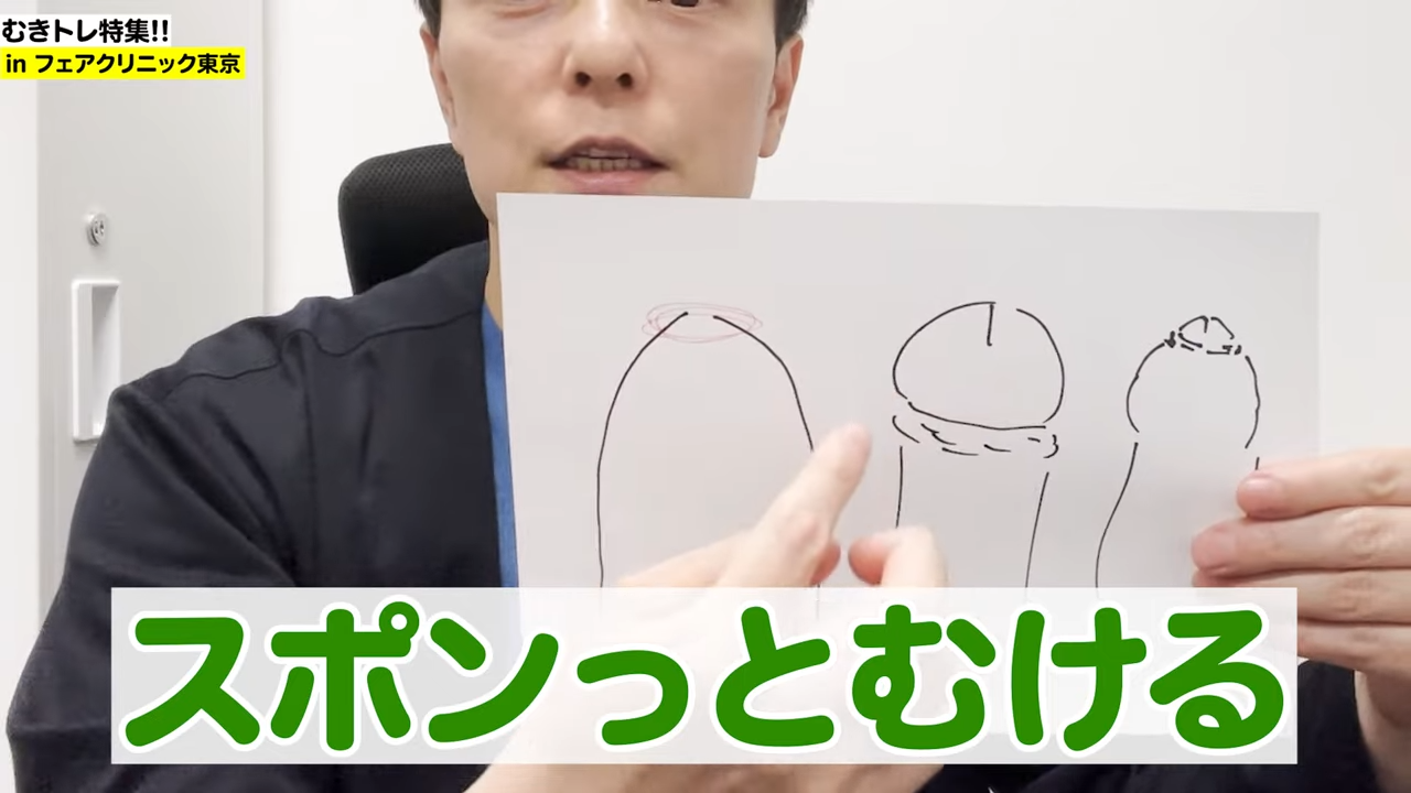 高校生の包茎とは？自然と改善？取れる選択肢と包茎の注意点のお話 - アトムクリニック -