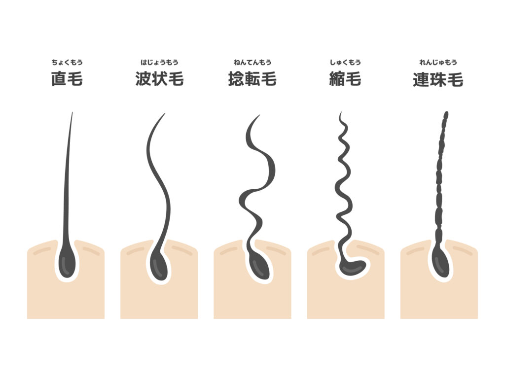 髪の毛を抜くとはげる？癖や病気で抜き続けるリスクやまた生えてくるかも解説 | 育毛のミカタ