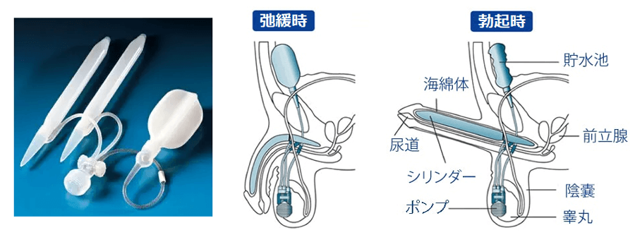 TENGA】オナホで早漏は改善できる。早漏改善に役立つオナホ3選｜あんしん通販コラム