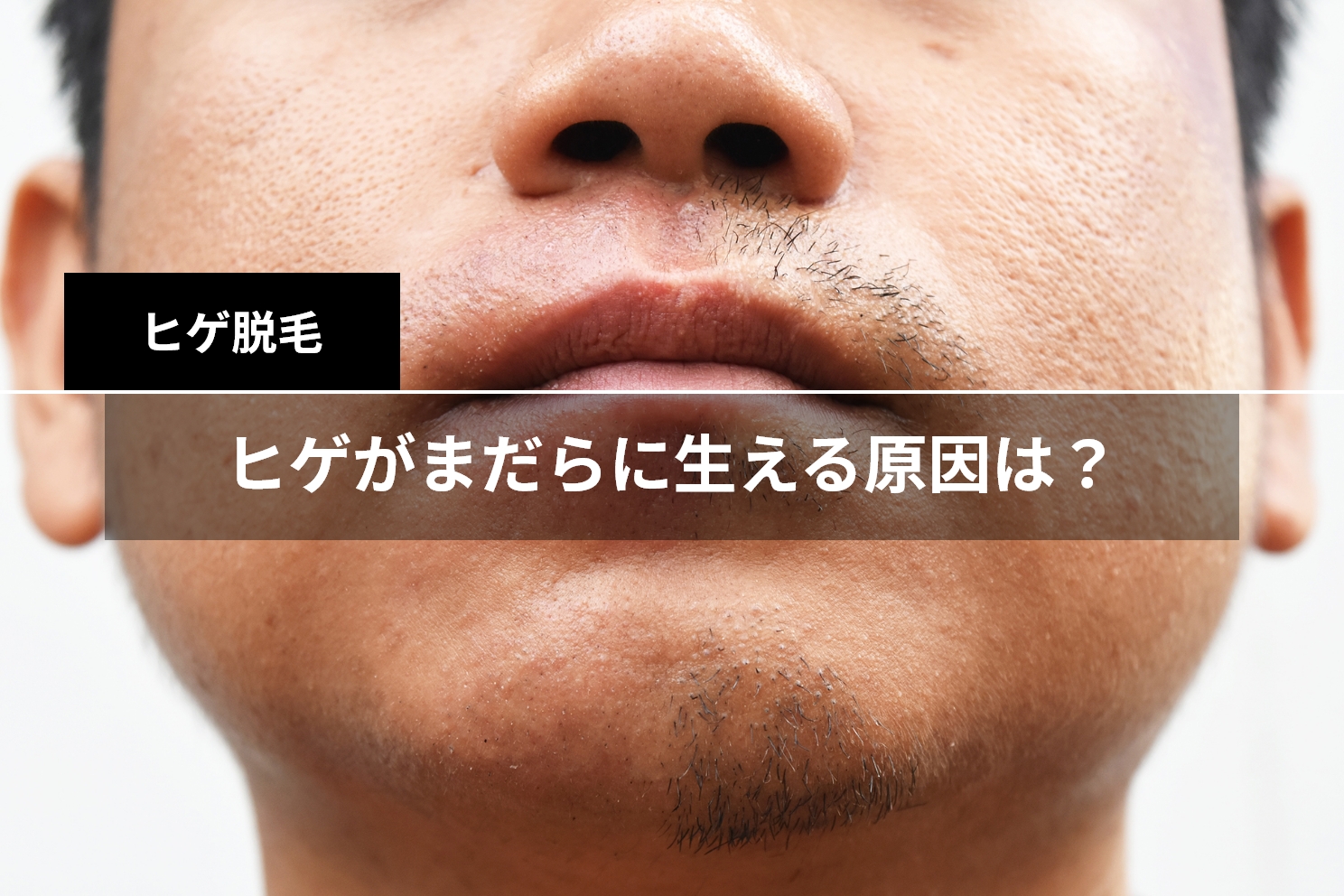 Plucking facial hair】ずっと見ていられる絶頂のヒゲ抜き