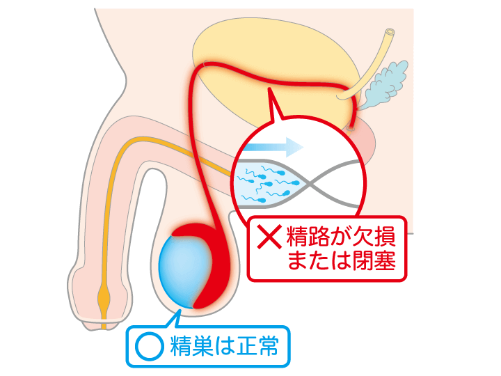 達人に聞く「夢精を誘発させるための3か条」とは « 日刊SPA!